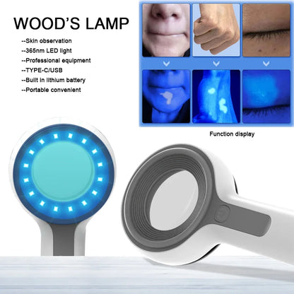 Wood'S Lamp Ultraviolet Skin Analysis for Skin Examination Test Medical Diagnostic Analyzer Machine Personal Beauty Care