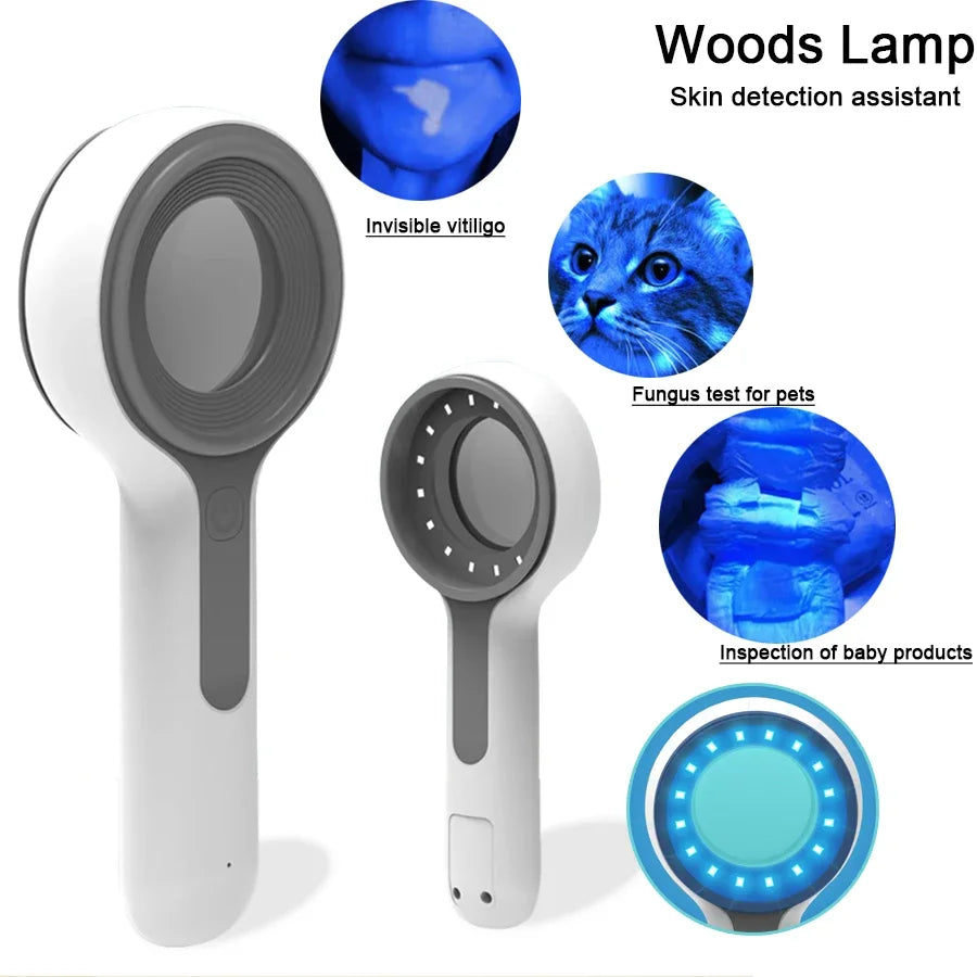 Wood'S Lamp Ultraviolet Skin Analysis for Skin Examination Test Medical Diagnostic Analyzer Machine Personal Beauty Care
